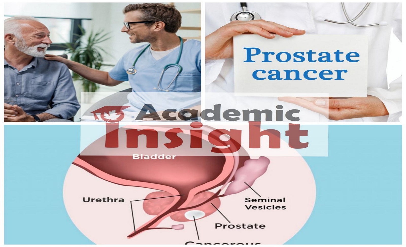 What are the prostate Cancer Risk Factors?