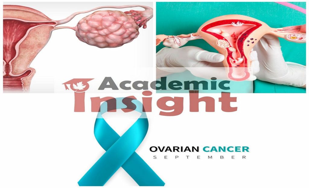 Ovarian cancer symptoms and the risk factors for it